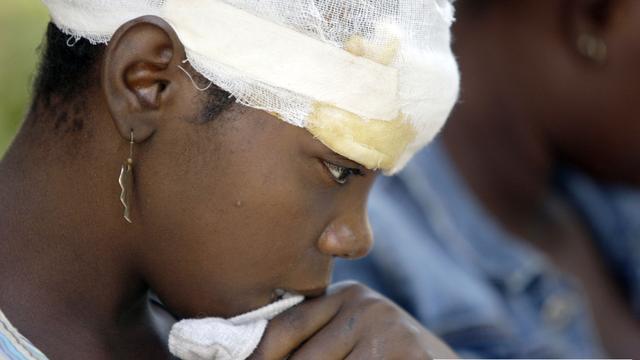 Natacha Justin, sopravvisuta al terremoto, aspetta di essere visitata da un dottore a Port-au-Prince, Haiti. © Jeffrey D. Allred, Deseret News